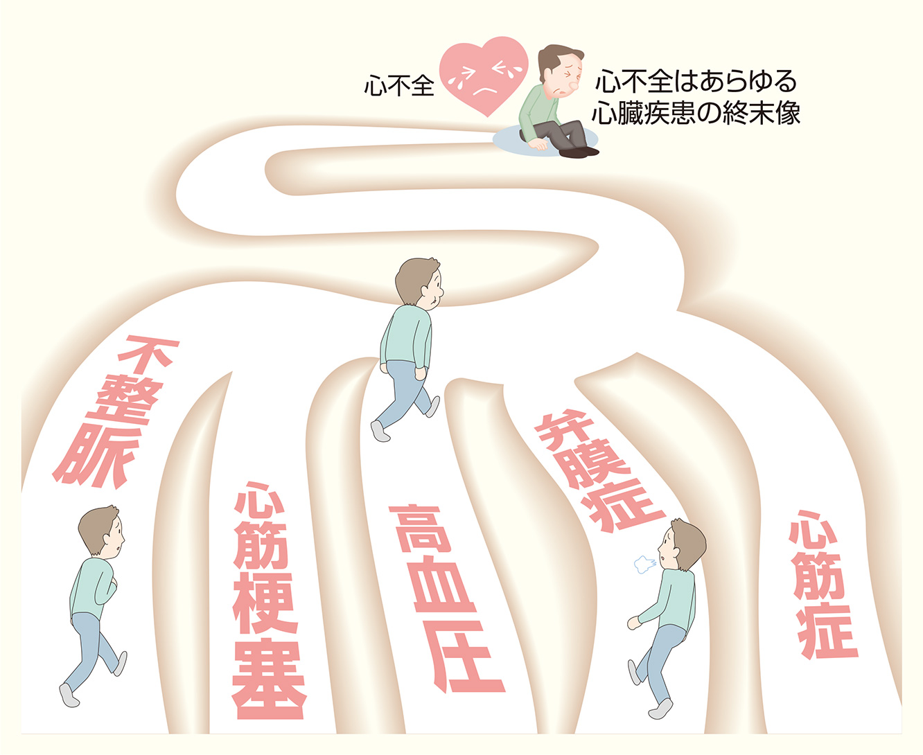 心不全への経過イラスト